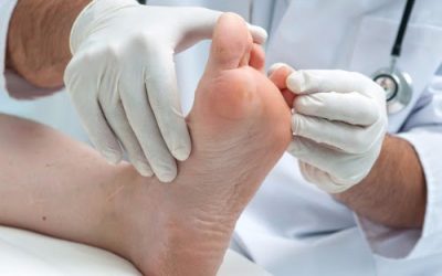 Q & A with Podiatrist: Dr. Lee Reiter