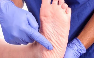 Q & A with Podiatrist