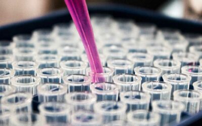 First Humans Dosed in New CMT Drug Trial